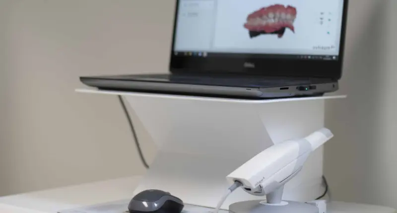 Ortodonzia Invisibile - Brescia Poliambulatorio Magellano - Tecnologia